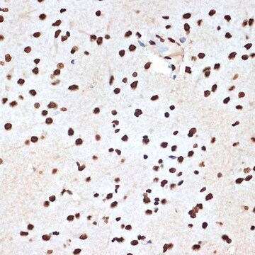 Anti-SET/TAF1 antibody produced in rabbit
