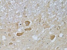 Anti-HDAC8 antibody produced in rabbit
