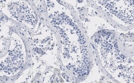 Anti-PKM2 Antibody, clone 1B2 ZooMAb&#174; Rabbit Monoclonal recombinant, expressed in HEK 293 cells