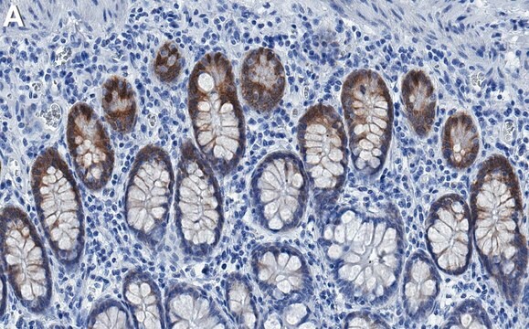 Anti-Musashi-1 Antibody, clone 2I14 ZooMAb&#174; Rabbit Monoclonal recombinant, expressed in HEK 293 cells