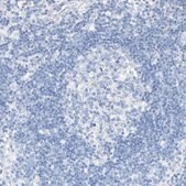Anti-KCNJ1 antibody produced in rabbit Prestige Antibodies&#174; Powered by Atlas Antibodies, affinity isolated antibody, buffered aqueous glycerol solution