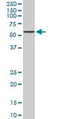Monoclonal Anti-CACNB2 antibody produced in mouse clone 6C1, purified immunoglobulin, buffered aqueous solution