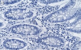 Anti-VHL Antibody, clone 1C10 ZooMAb&#174; Rabbit Monoclonal recombinant, expressed in HEK 293 cells
