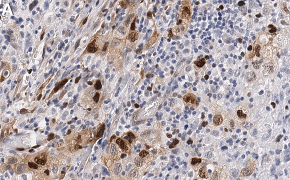 Anti-p-Rb-Ser807/811 Antibody, clone 3J7 ZooMAb&#174; Rabbit Monoclonal recombinant, expressed in HEK 293 cells