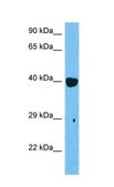 Anti-RARB antibody produced in rabbit affinity isolated antibody