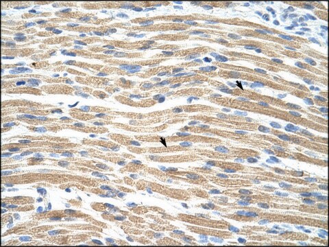 Anti-TEAD1 (AB1) antibody produced in rabbit affinity isolated antibody