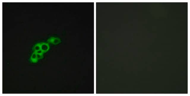 Anti-FSHR antibody produced in rabbit affinity isolated antibody