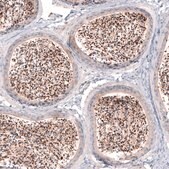 Anti-SKOR2 antibody produced in rabbit Prestige Antibodies&#174; Powered by Atlas Antibodies, affinity isolated antibody, buffered aqueous glycerol solution