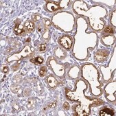 Anti-LTF antibody produced in rabbit Prestige Antibodies&#174; Powered by Atlas Antibodies, affinity isolated antibody, buffered aqueous glycerol solution