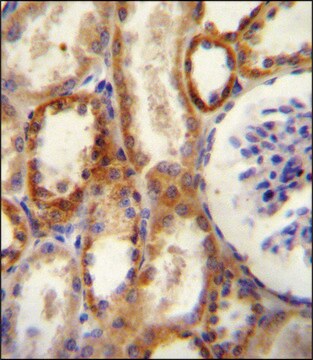 ANTI-CD73 (NT5E)(N-TERMINAL) antibody produced in rabbit IgG fraction of antiserum, buffered aqueous solution