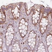 Anti-FPR1 antibody produced in rabbit Prestige Antibodies&#174; Powered by Atlas Antibodies, affinity isolated antibody, buffered aqueous glycerol solution