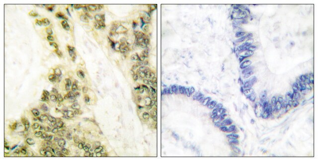 Anti-Thyroid Hormone Receptor &#945;, N-Terminal antibody produced in rabbit affinity isolated antibody