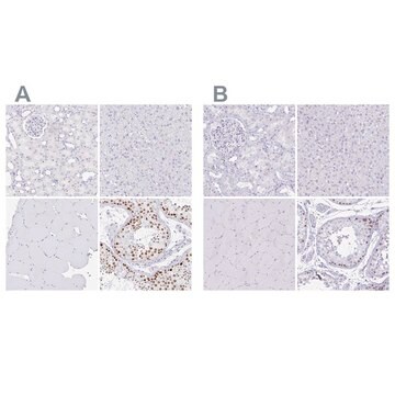 Anti-CXorf67 antibody produced in rabbit Prestige Antibodies&#174; Powered by Atlas Antibodies, affinity isolated antibody, buffered aqueous glycerol solution