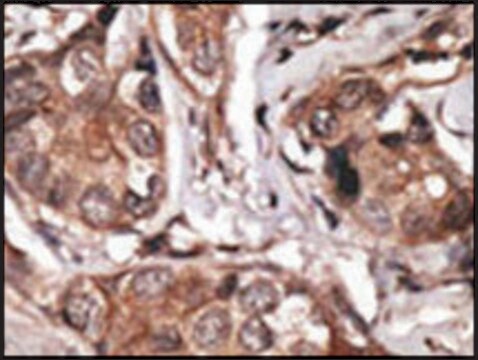 Anti-HtrA1 (C-term) antibody produced in rabbit IgG fraction of antiserum, buffered aqueous solution