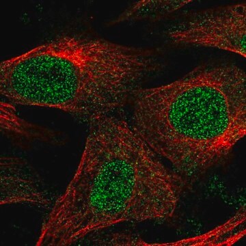 Anti-EPM2A antibody produced in rabbit Prestige Antibodies&#174; Powered by Atlas Antibodies, affinity isolated antibody, buffered aqueous glycerol solution