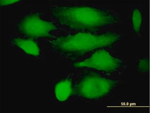 Anti-TRIM21 antibody produced in mouse purified immunoglobulin, buffered aqueous solution