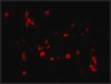 Anti-Cathelicidin antibody produced in rabbit affinity isolated antibody, buffered aqueous solution