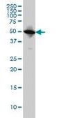 Monoclonal Anti-TUBA6 antibody produced in mouse clone S11, purified immunoglobulin, buffered aqueous solution