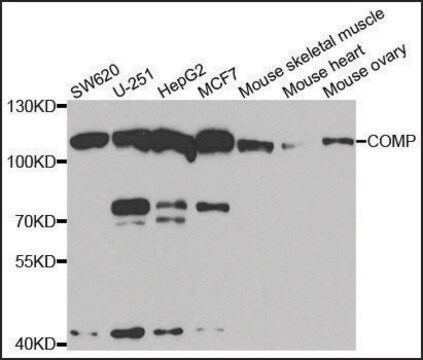 Anti-COMP antibody produced in rabbit affinity isolated antibody