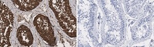 Anti-HSC70 Antibody, clone 1B15 ZooMAb&#174; Rabbit Monoclonal recombinant, expressed in HEK 293 cells