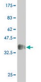 Monoclonal Anti-MAP2K5 antibody produced in mouse clone 1E5, purified immunoglobulin, buffered aqueous solution