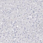 Anti-FLG antibody produced in rabbit Prestige Antibodies&#174; Powered by Atlas Antibodies, affinity isolated antibody, buffered aqueous glycerol solution, ab3