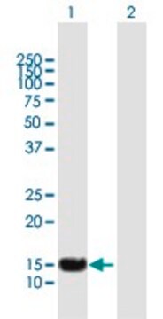 Anti-SP140 antibody produced in mouse purified immunoglobulin, buffered aqueous solution