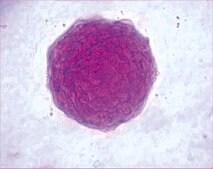 ES Cell Characterization Kit The Embryonic Stem Cell Characterization Kit phenotypically assesses the differentiation status of ES cells by measuring their AP activity, cell-surface stage-specific antigens (SSEA-1, SSEA-4) as well as expression of TRA-1-60, TRA-1-81 antigens.