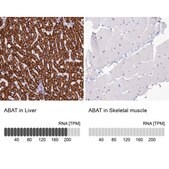 Anti-ABAT antibody produced in rabbit Prestige Antibodies&#174; Powered by Atlas Antibodies, affinity isolated antibody, buffered aqueous glycerol solution