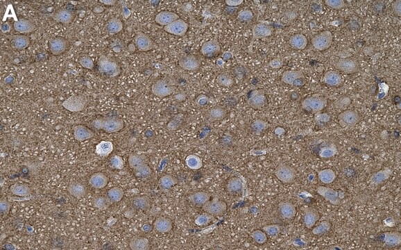 Anti-Tau Antibody, clone T49 ZooMAb&#174; Mouse Monoclonal recombinant, expressed in HEK 293 cells