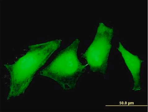 Monoclonal Anti-ASPA antibody produced in mouse clone 3C11, purified immunoglobulin, buffered aqueous solution