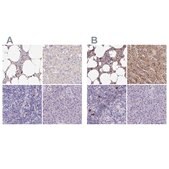 Anti-CAT antibody produced in rabbit Prestige Antibodies&#174; Powered by Atlas Antibodies, affinity isolated antibody, buffered aqueous glycerol solution