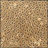 Bovine Pulmonary Artery Endothelial Cells: BPAEC (Cryovial)