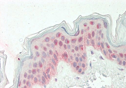 Anti-KLF10 antibody produced in rabbit affinity isolated antibody