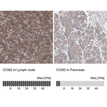 Anti-CCM2 antibody produced in rabbit Prestige Antibodies&#174; Powered by Atlas Antibodies, affinity isolated antibody, buffered aqueous glycerol solution, Ab2