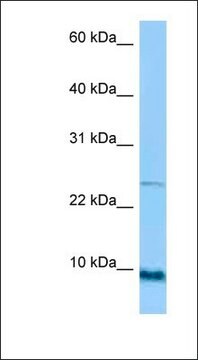 Anti-SPRR1A antibody produced in rabbit affinity isolated antibody