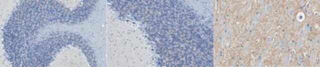 Anti-DYRK1A Antibody, clone 7F3 clone 7F3, from mouse