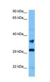 Anti-TNNT1 antibody produced in rabbit affinity isolated antibody
