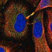 Anti-GSTM1 antibody produced in rabbit Prestige Antibodies&#174; Powered by Atlas Antibodies, affinity isolated antibody, buffered aqueous glycerol solution