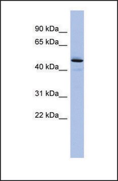 Anti-PCOLCE antibody produced in rabbit affinity isolated antibody