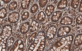 Anti-Calpain-1 Antibody, clone 1H14 ZooMAb&#174; Rabbit Monoclonal recombinant, expressed in HEK 293 cells