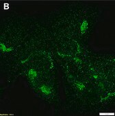 Anti-&#945;-amylase Antibody, clone 1G14 ZooMAb&#174; Rabbit Monoclonal recombinant, expressed in HEK 293 cells
