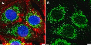 Anti-Cardiac Troponin T Antibody, clone 1G6 ZooMAb&#174; Rabbit Monoclonal recombinant, expressed in HEK 293 cells