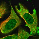 Anti-PRKD3 antibody produced in rabbit Prestige Antibodies&#174; Powered by Atlas Antibodies, affinity isolated antibody, buffered aqueous glycerol solution