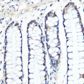 Anti-Chk1 Antibody, clone 0S3Q1, Rabbit Monoclonal