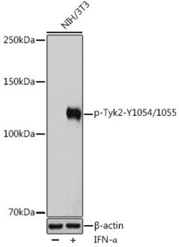 Anti-Phospho-Tyk2-Y1054/1055 antibody produced in rabbit