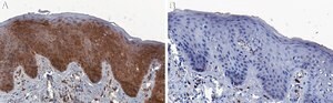 Anti-Cytokeratin-17 Antibody, clone 2K20 ZooMAb&#174; Rabbit Monoclonal recombinant, expressed in HEK 293 cells