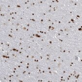Anti-TOP2B antibody produced in rabbit Prestige Antibodies&#174; Powered by Atlas Antibodies, affinity isolated antibody, buffered aqueous glycerol solution
