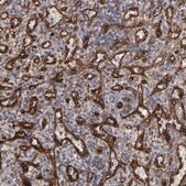 Anti-SLC9A3R2 antibody produced in rabbit Prestige Antibodies&#174; Powered by Atlas Antibodies, affinity isolated antibody, buffered aqueous glycerol solution