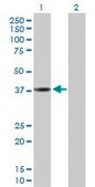 Anti-CTSL1 antibody produced in rabbit purified immunoglobulin, buffered aqueous solution